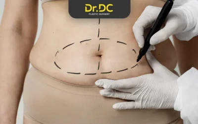 Coolsculpting vs Liposuction: Key Differences, Effectiveness, and Considerations