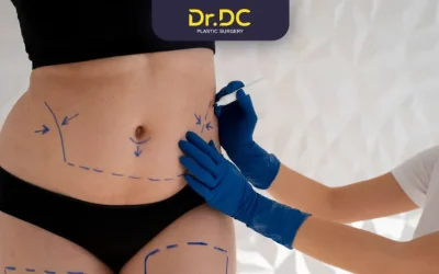 Is liposuction dangerous? Understanding Risks & Safety Measures