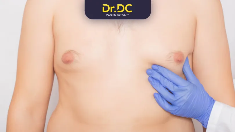 How-Do-I-Know-If-I-Have-Gynecomastia if i have gynecomastia