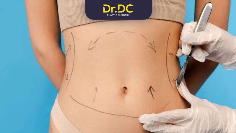 Liposuction areas