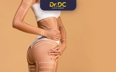 Who is An Ideal Candidate for Liposuction?