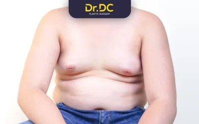 Teenage Gynecomastia: Non-Surgical Treatments