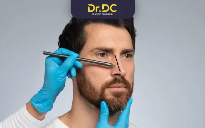 The Ideal Candidate for Rhinoplasty