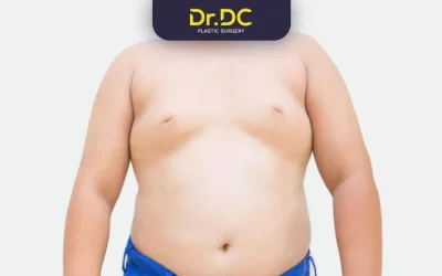 Gynaecomastia in puberty: Lifestyle & Professional Tips
