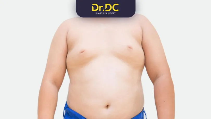gynecomastia in puberty