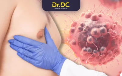 Gynecomastia Surgery न करने से आपको CANCER होगा | Dr. Dhruv Chavan