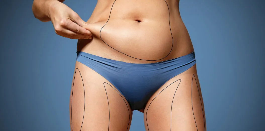 Body-Contouring-Liposuction Body Contouring Liposuction