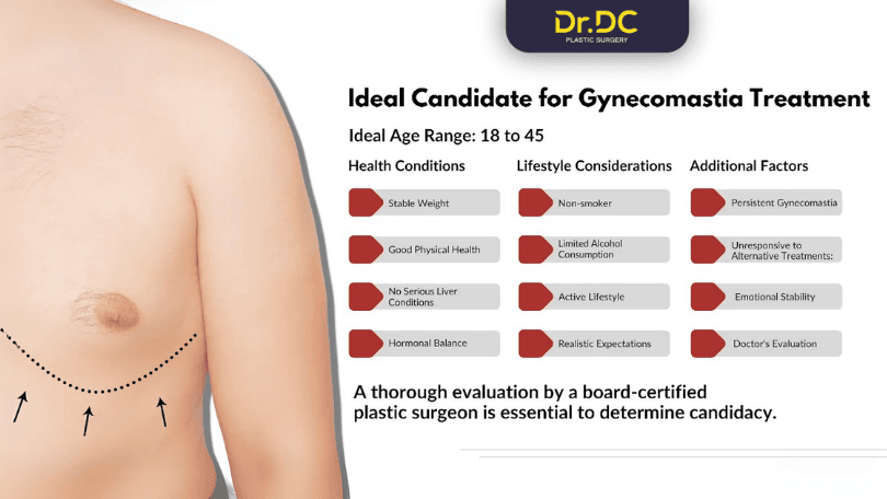 Candidate for Gynecomastia Candidate for Gynecomastia