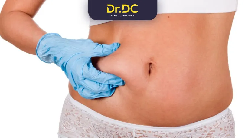 fat back liposuction