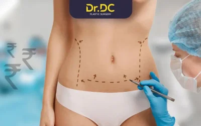 Liposuction Cost in India 2025