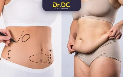 Tummy Tuck vs Liposuction: Which Is Right for You?