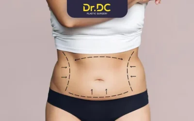 Why is Liposuction the best choice for fat reduction?