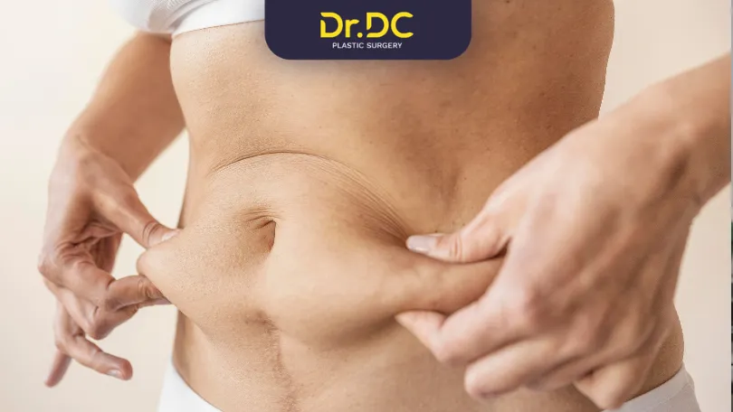 Top Benefits of Abdominoplasty Why Patients Choose Tummy Tucks