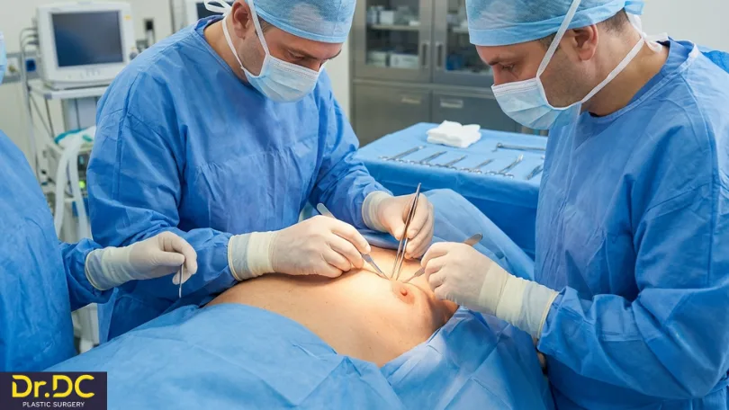 Gynecomastia Surgery Scarring: What to Expect and How to Minimise It?