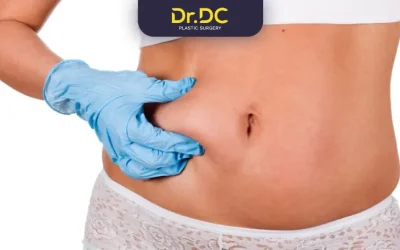Does Fat Grow Back After Liposuction?